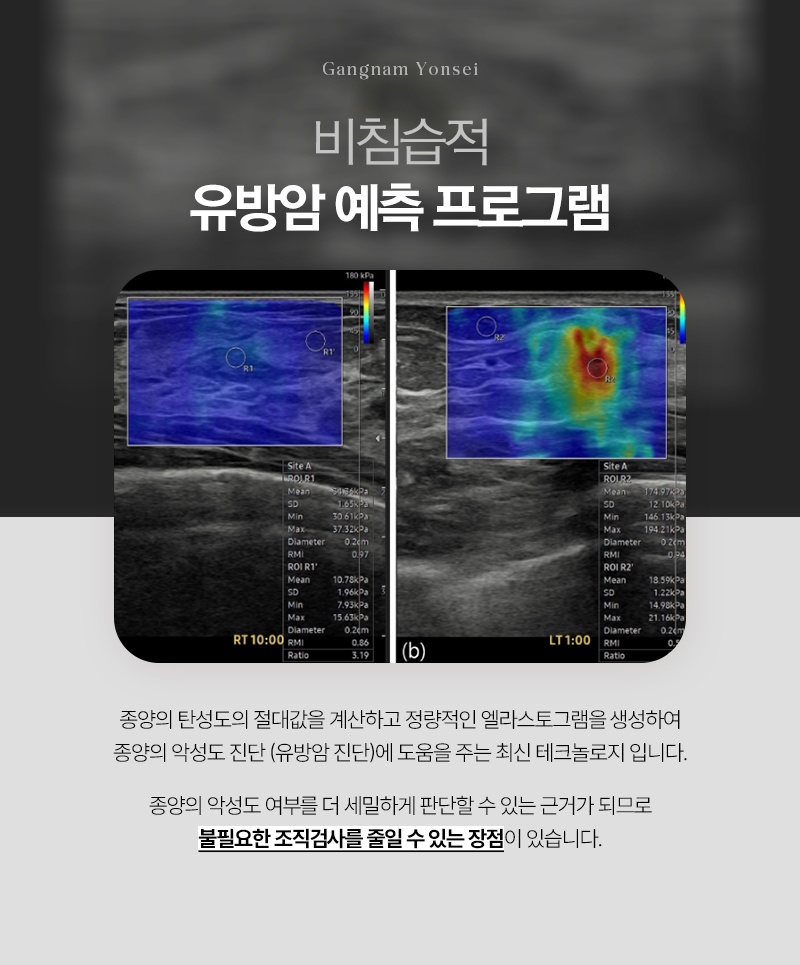 2410_강남연세외과_이미지컨텐츠_맘모톰 (11).jpg